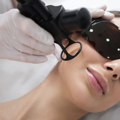 resurfacing na twarz laser frakcyjny