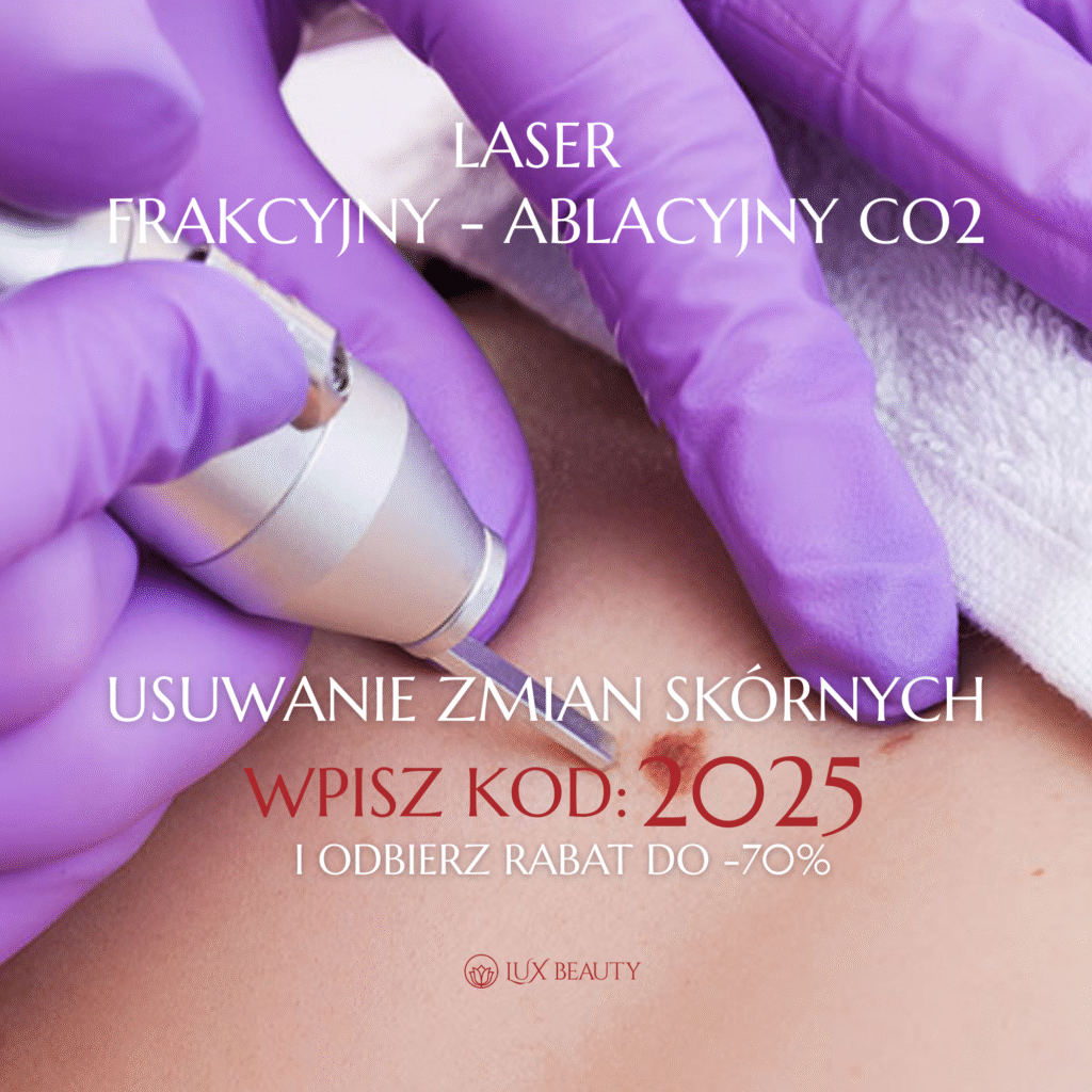 usuwanie zmian skórnych laserem