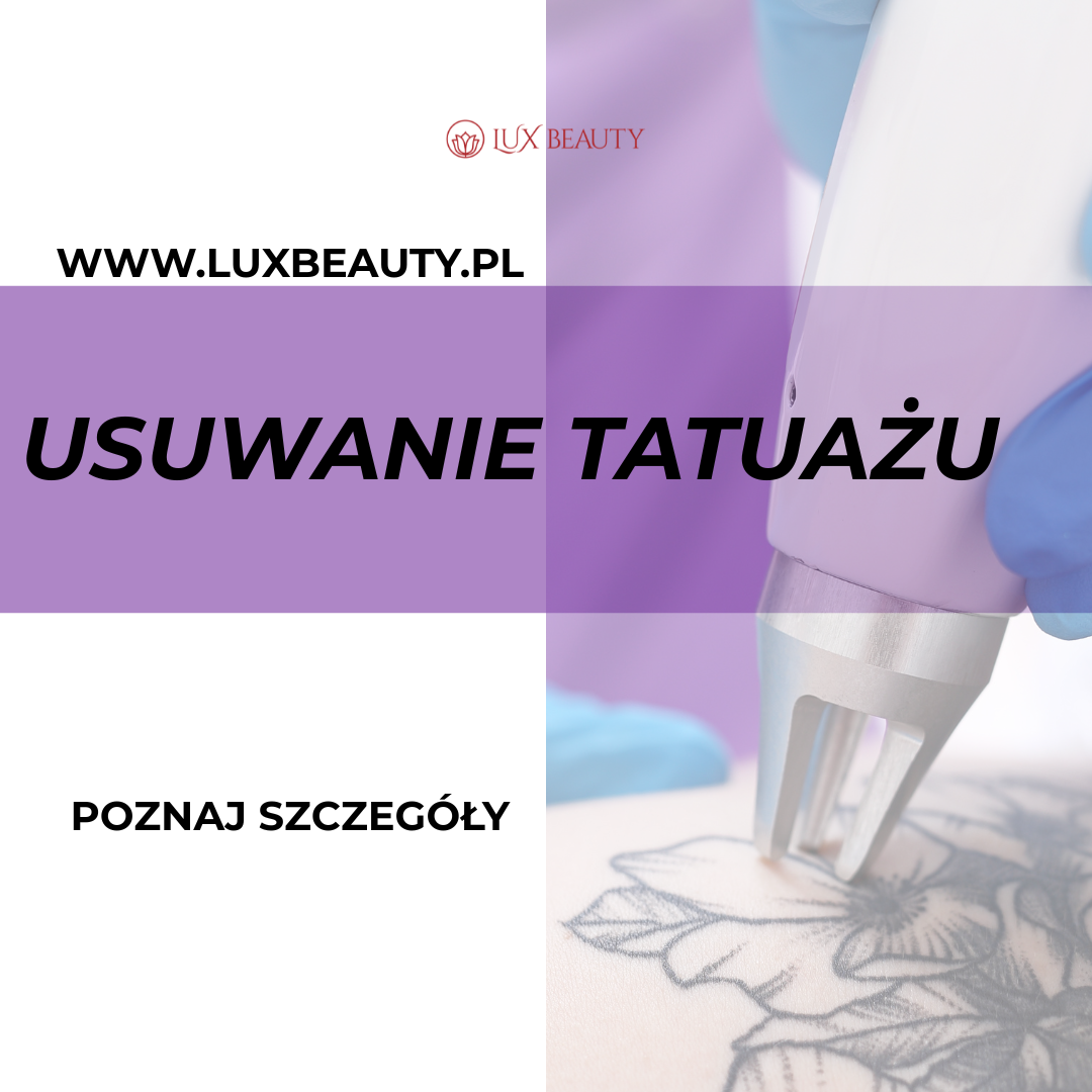 laserowe usuwanie tatuażu warszawa