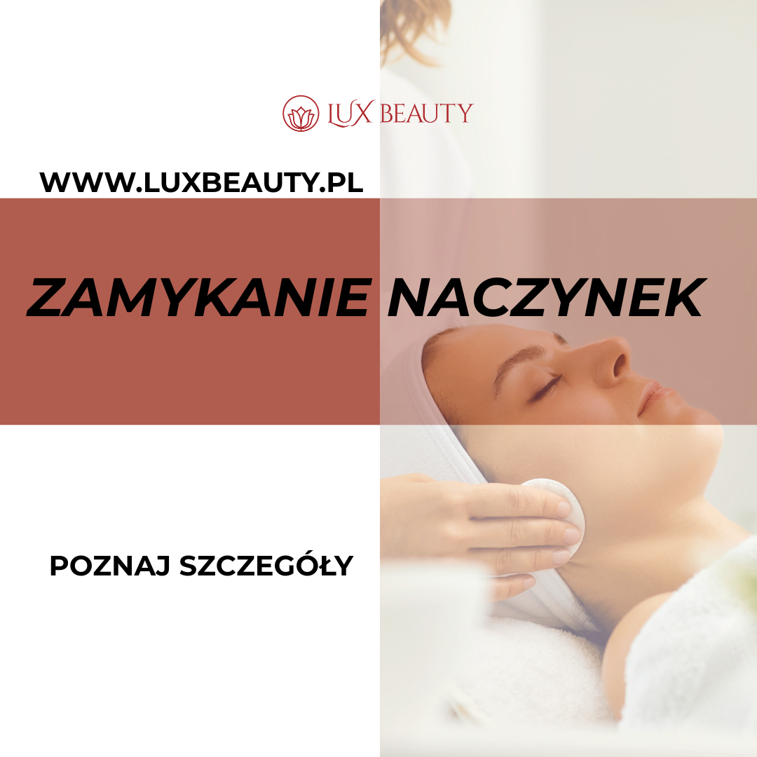 laserowe zamykanie naczynek warszawa